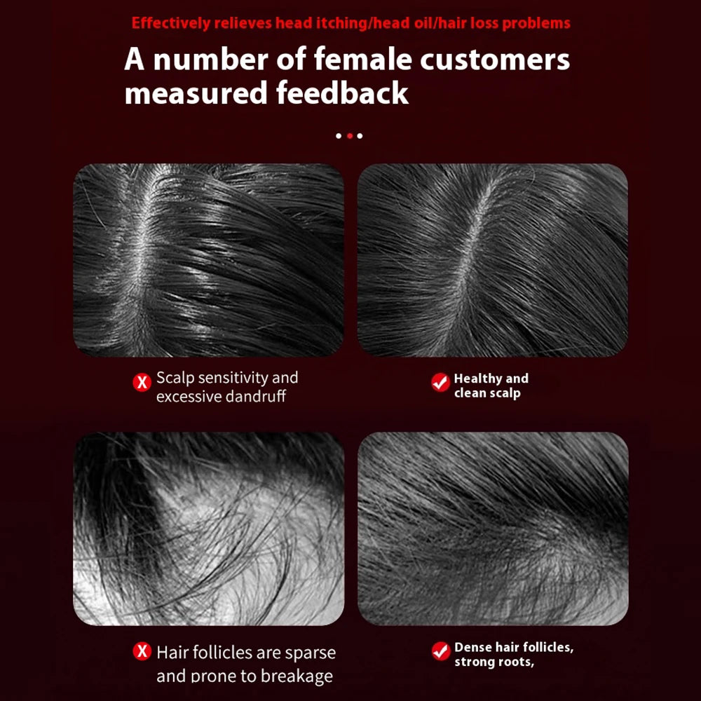 LuminScalp™ Electric Scalp Massager with Oil Application