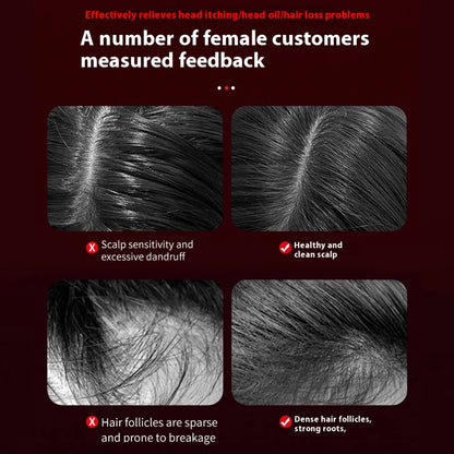 LuminScalp™ Electric Scalp Massager with Oil Application